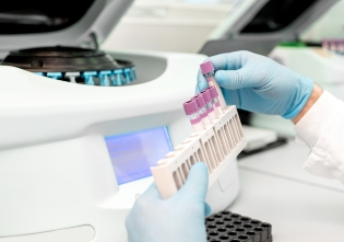 Test Tubes Analyzer Machine
